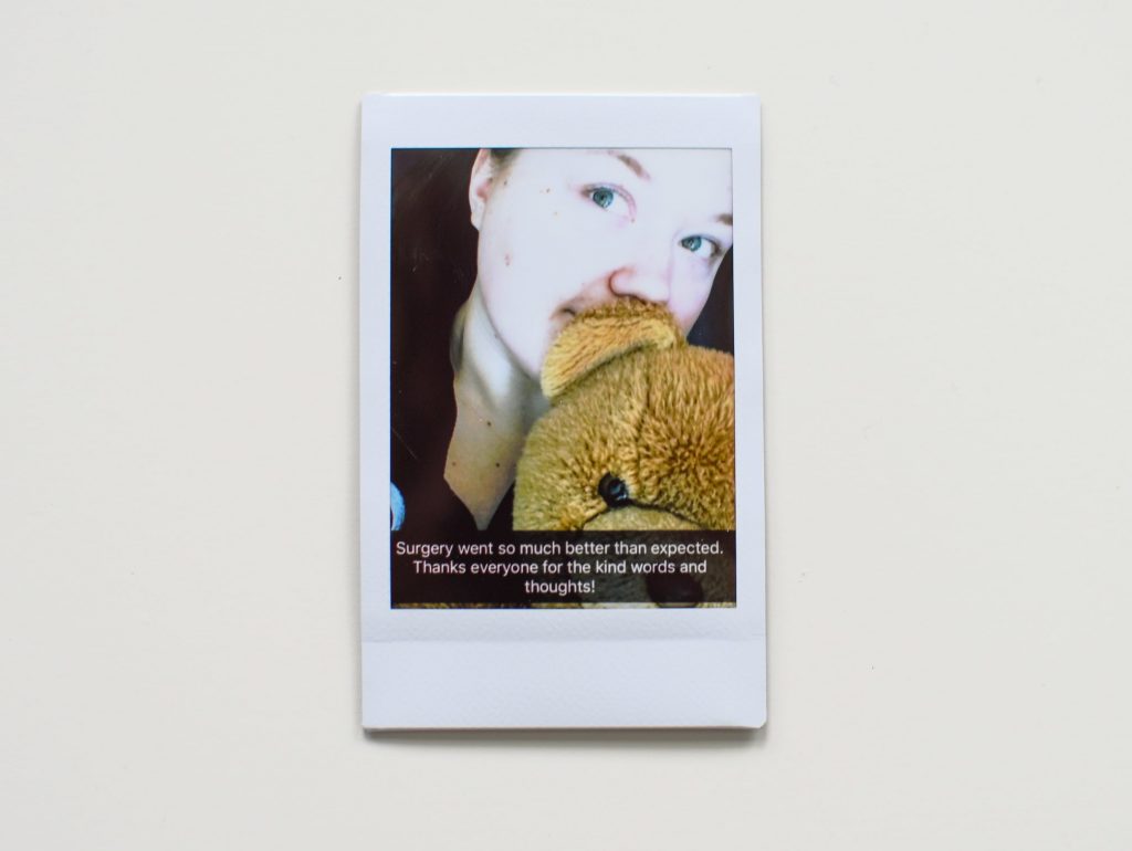 A polaroid image of Rebecca holding her teddy bear just out of surgery. 